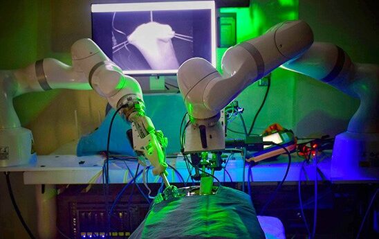Robot performs first laparoscopic surgery without human help